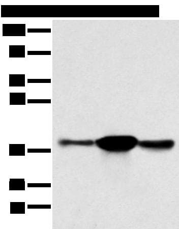 Polyclonal Rabbit anti-Human Sprouty 4 / SPRY4 Antibody (IHC, WB)