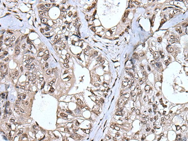Polyclonal Rabbit anti-Human TIA-1 Antibody (IHC, WB)