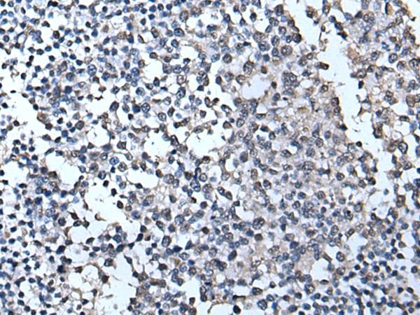 Polyclonal Rabbit anti-Human TIA-1 Antibody (IHC, WB)
