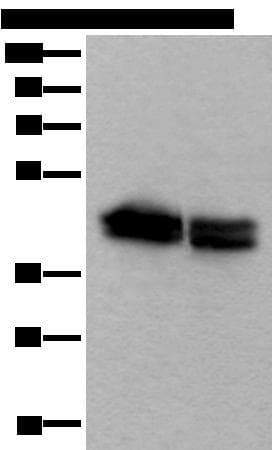 Polyclonal Rabbit anti-Human TIA-1 Antibody (IHC, WB)