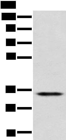 Polyclonal Rabbit anti-Human CD1D Antibody (IHC, WB)