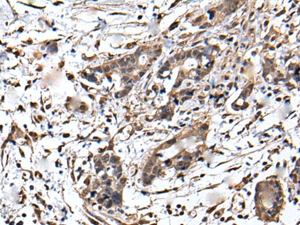 Polyclonal Rabbit anti-Human ZFP36 / Tristetraprolin Antibody (IHC)