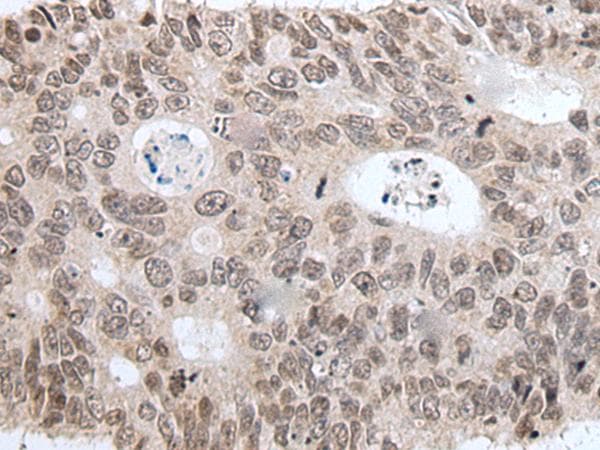Polyclonal Rabbit anti-Human HIST1H3A Antibody (IHC, WB)