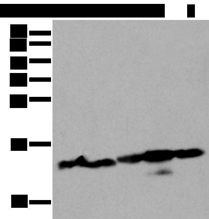 Polyclonal Rabbit anti-Human HIST1H3A Antibody (IHC, WB)