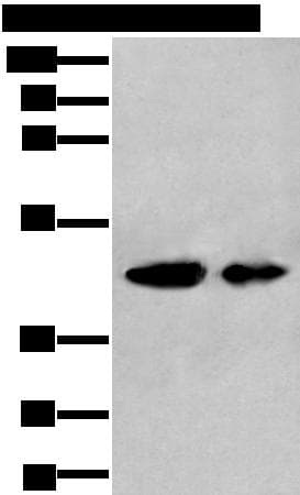 Polyclonal Rabbit anti-Human VASP Antibody (IHC, WB)