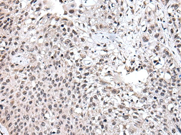 Polyclonal Rabbit anti-Human UBE2E3 Antibody (IHC)
