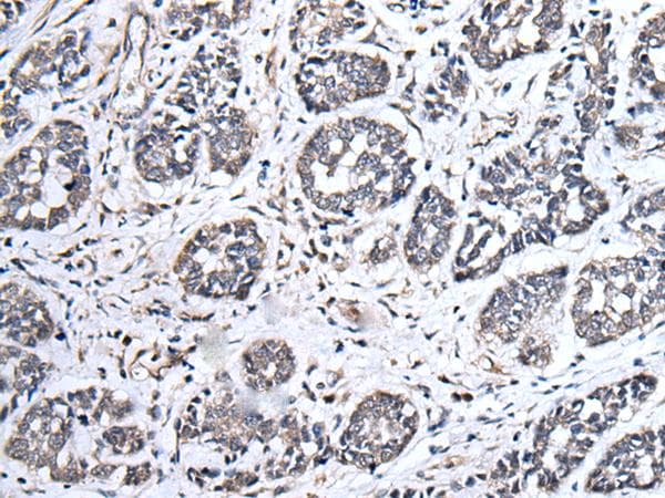 Polyclonal Rabbit anti-Human UBE2E3 Antibody (IHC)