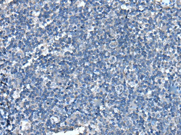 UFC1 Antibody