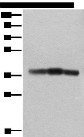 ATAD1 Antibody