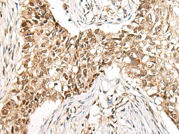 Polyclonal Rabbit anti-Human CCDC181 / C1orf114 Antibody (IHC)