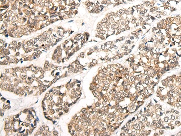 Polyclonal Rabbit anti-Human CCDC181 / C1orf114 Antibody (IHC)