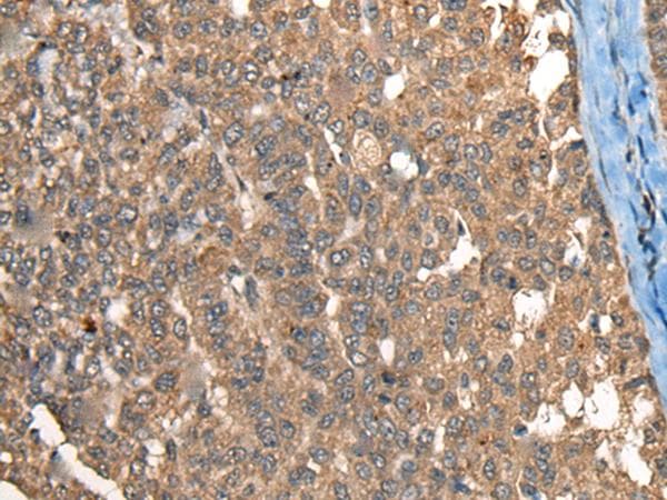 Polyclonal Rabbit anti-Human Complement C1R Antibody (IHC, WB)