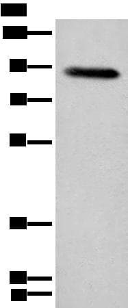 Polyclonal Rabbit anti-Human Complement C1R Antibody (IHC, WB)