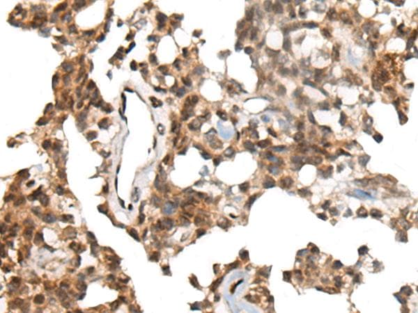 Polyclonal Rabbit anti-Human CALML5 Antibody (IHC)