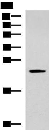 Polyclonal Rabbit anti-Human CMPK / CMPK1 Antibody (WB)