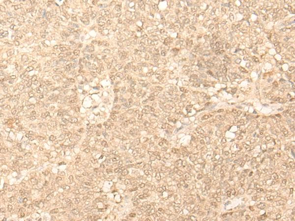 Polyclonal Rabbit anti-Human FAH Antibody (IHC, WB)