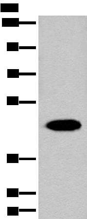 Polyclonal Rabbit anti-Human FAH Antibody (IHC, WB)