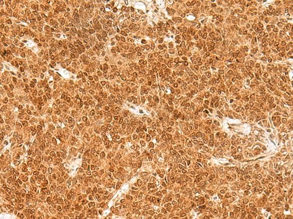 Polyclonal Rabbit anti-Human TOR1A / Torsin A Antibody (IHC)