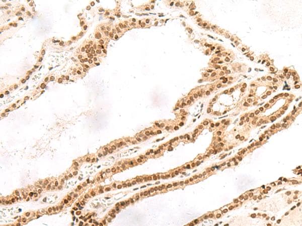 Polyclonal Rabbit anti-Human TOR1A / Torsin A Antibody (IHC)