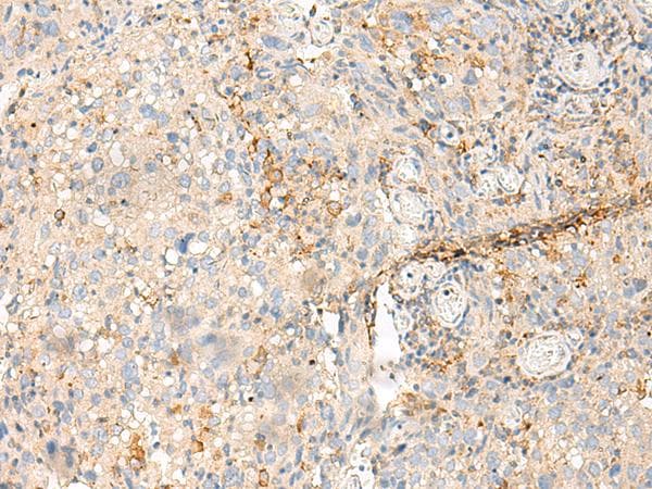 Polyclonal Rabbit anti-Human MDFI / I-MF Antibody (IHC)