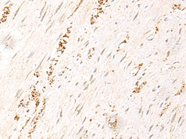 Polyclonal Rabbit anti-Human MDFI / I-MF Antibody (IHC)