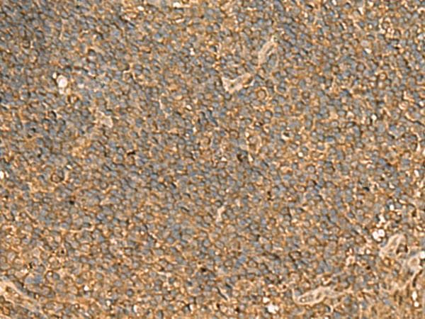Polyclonal Rabbit anti-Human ENO3 / Enolase 3 Antibody (IHC, WB)