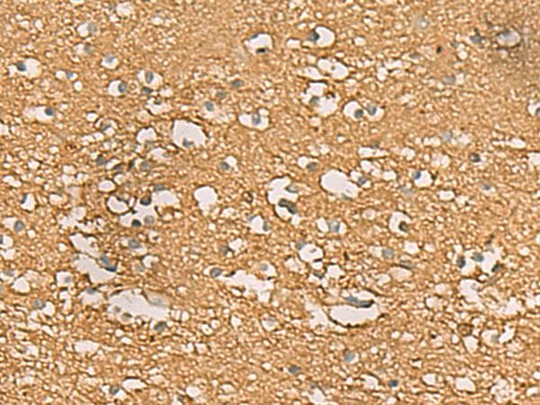 Polyclonal Rabbit anti-Human ENO3 / Enolase 3 Antibody (IHC, WB)