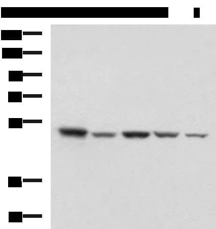 Polyclonal Rabbit anti-Human ENO3 / Enolase 3 Antibody (IHC, WB)