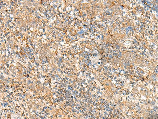 Polyclonal Rabbit anti-Human FKBP1A / FKBP12 Antibody (IHC)