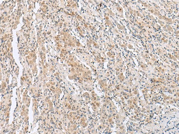 Polyclonal Rabbit anti-Human HIST1H2BN Antibody (IHC)