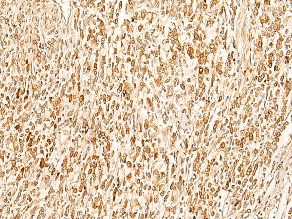 Polyclonal Rabbit anti-Human SMUG1 Antibody (IHC)