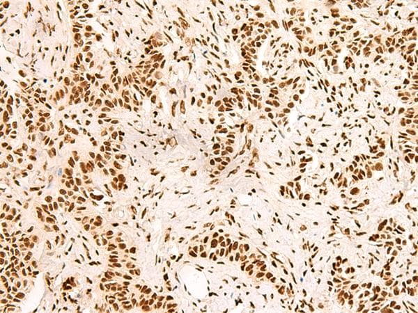 SNRPB2 Antibody