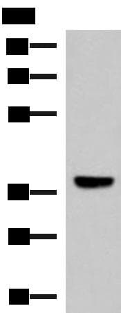 Polyclonal Rabbit anti-Human LRG1 / LRG Antibody (IHC, WB)
