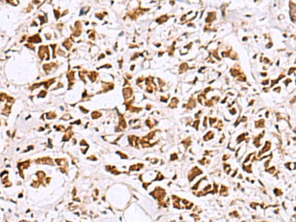 Polyclonal Rabbit anti-Human EWSR1 / EWS Antibody (IHC, WB)