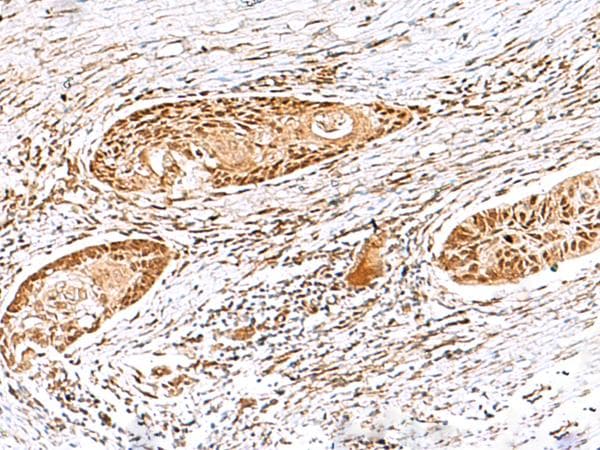 Polyclonal Rabbit anti-Human EWSR1 / EWS Antibody (IHC, WB)
