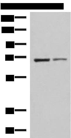 Polyclonal Rabbit anti-Human EWSR1 / EWS Antibody (IHC, WB)