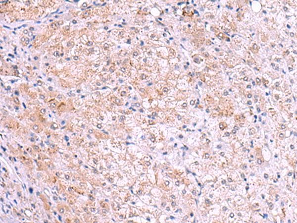 Polyclonal Rabbit anti-Human KIR3DL1 Antibody (IHC, WB)