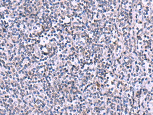 Polyclonal Rabbit anti-Human KIR3DL1 Antibody (IHC, WB)