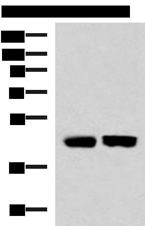 Polyclonal Rabbit anti-Human KIR3DL1 Antibody (IHC, WB)