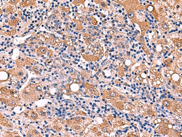 Polyclonal Rabbit anti-Human FDXR Antibody (IHC, WB)