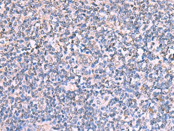 Polyclonal Rabbit anti-Human FDXR Antibody (IHC, WB)