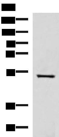 Polyclonal Rabbit anti-Human FDXR Antibody (IHC, WB)
