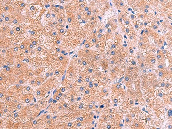 Polyclonal Rabbit anti-Human ZAP70 Antibody (IHC, WB)