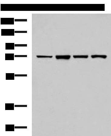 Polyclonal Rabbit anti-Human ZAP70 Antibody (IHC, WB)