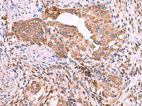 Polyclonal Rabbit anti-Human EEF1D Antibody (IHC, WB)