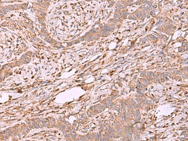 Polyclonal Rabbit anti-Human EEF1D Antibody (IHC, WB)