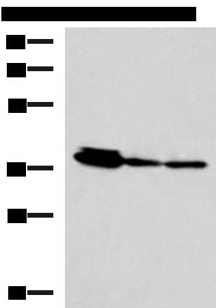 Polyclonal Rabbit anti-Human EEF1D Antibody (IHC, WB)