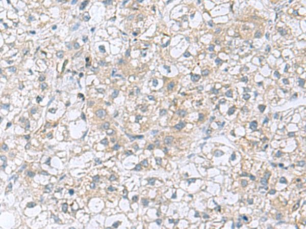 TRO / Trophonin Antibody