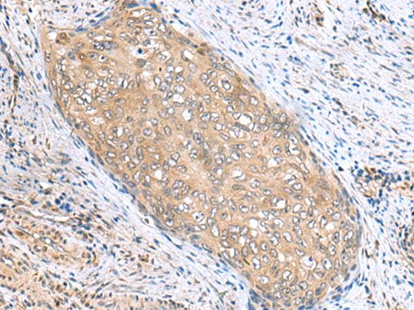 Polyclonal Rabbit anti-Human PHPT1 Antibody (IHC, WB)