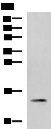 Polyclonal Rabbit anti-Human PHPT1 Antibody (IHC, WB)